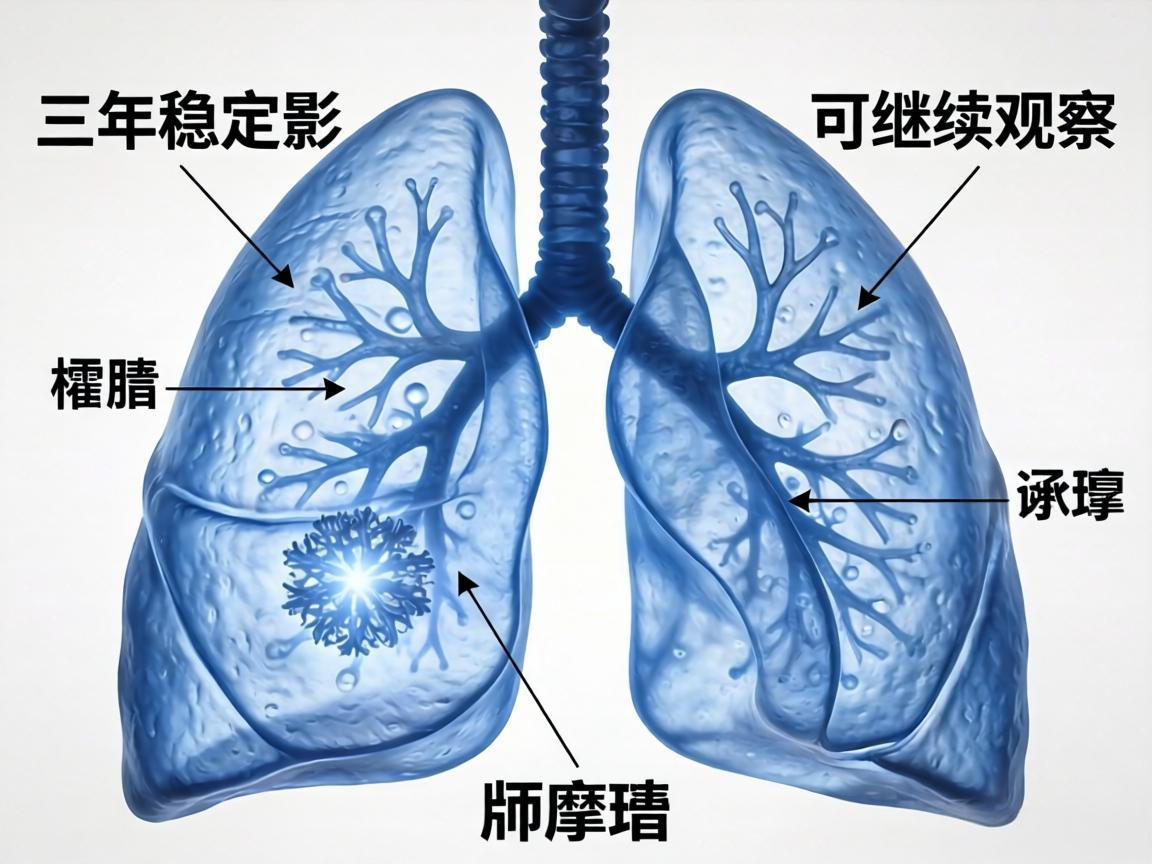 肺磨玻璃影三年稳定可继续观察